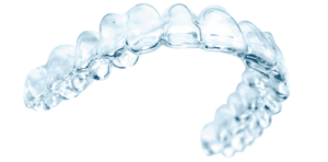 Les gouttières transparentes du traitement orthodontie invisible pour adultes